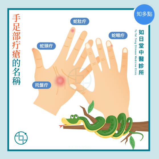 中醫看疔瘡 - 如日堂中醫診所 Yu Yat Tong Chinese Medicine Clinic