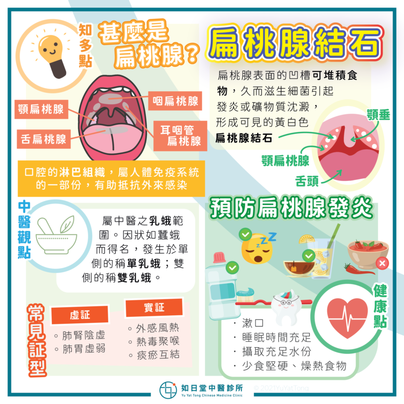 20210530_扁桃腺結石-21