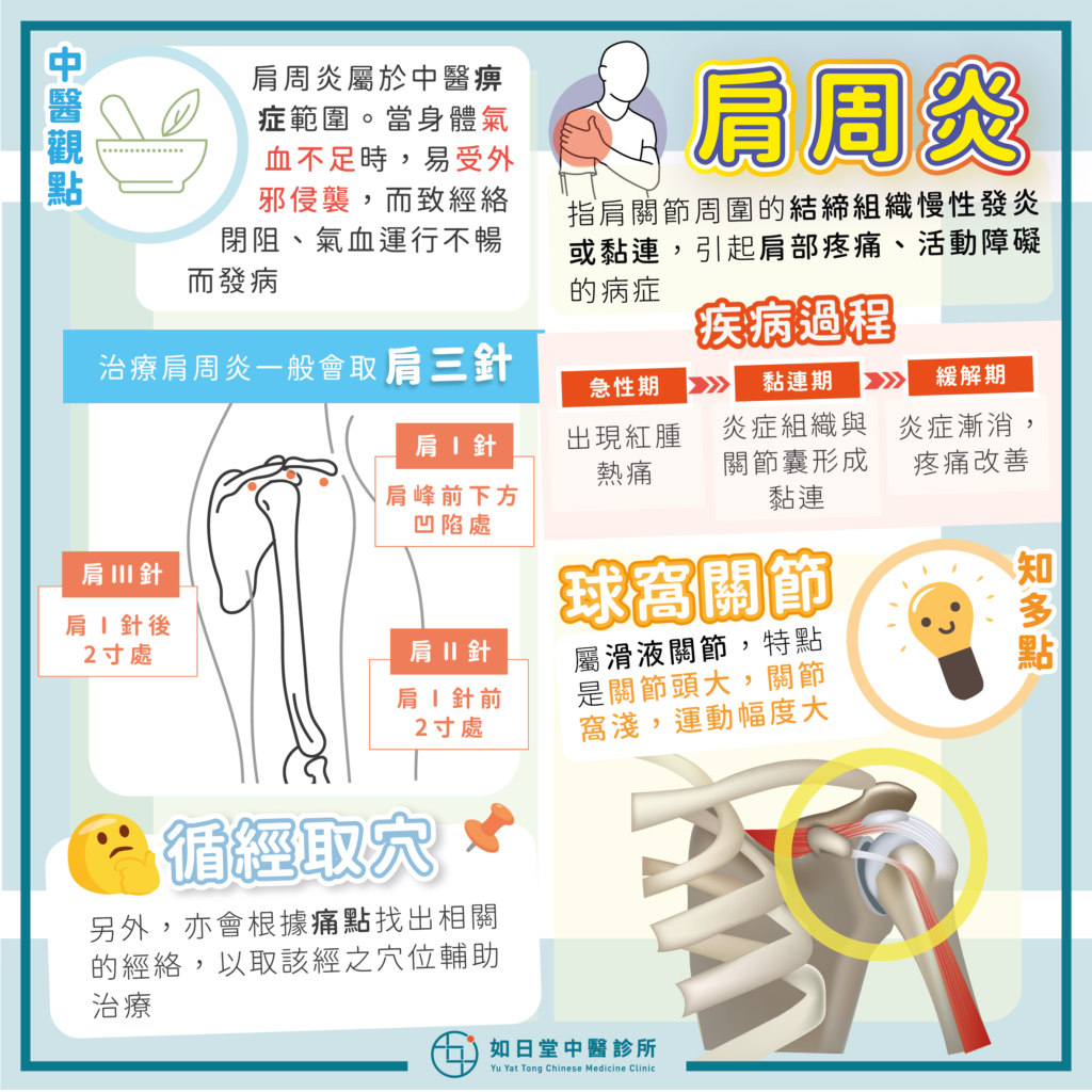 肩周炎
