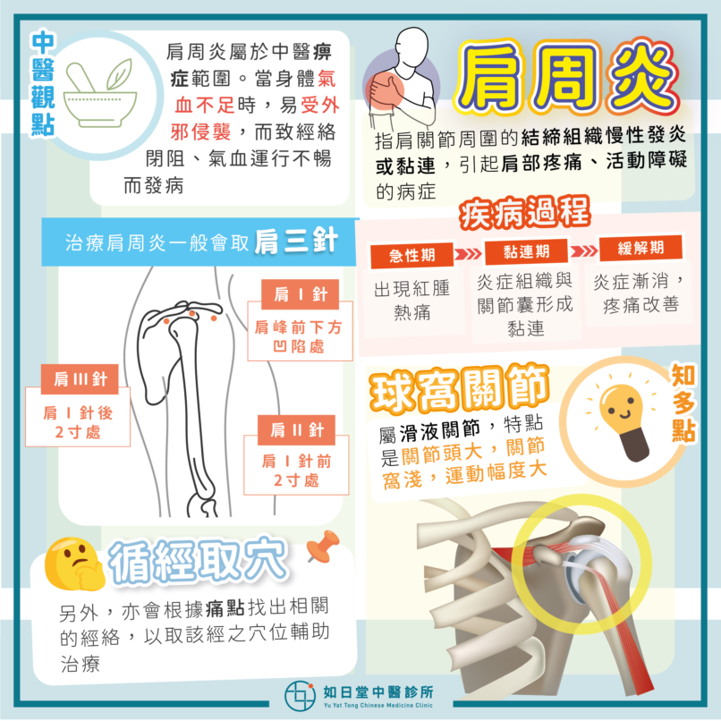 20210613_肩周炎-23