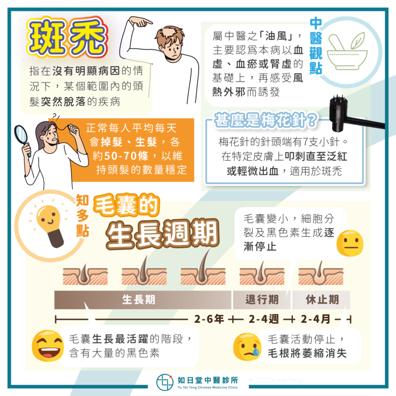 20211224_斑禿-45