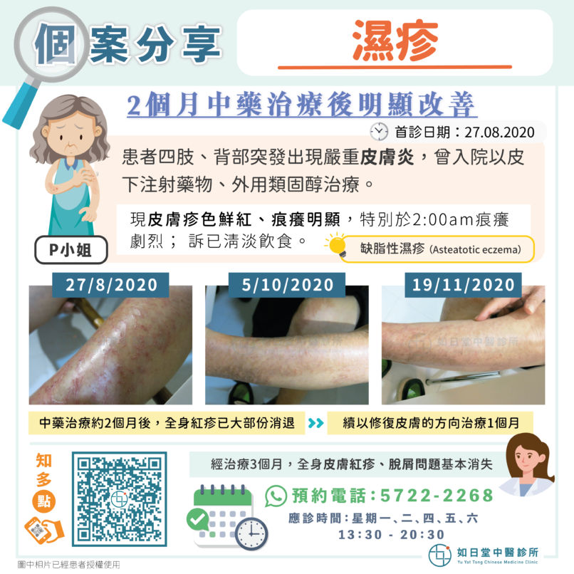 20230426_濕疹-2