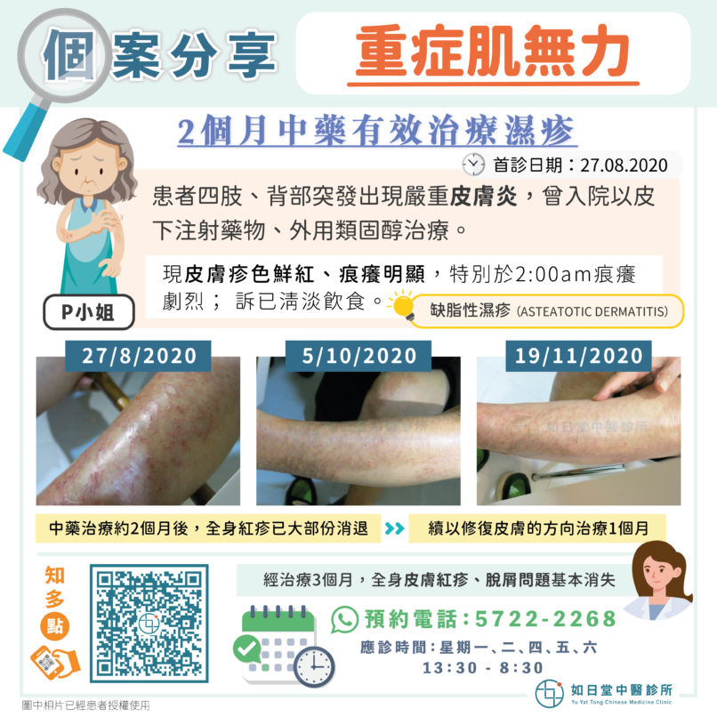 20230426_濕疹