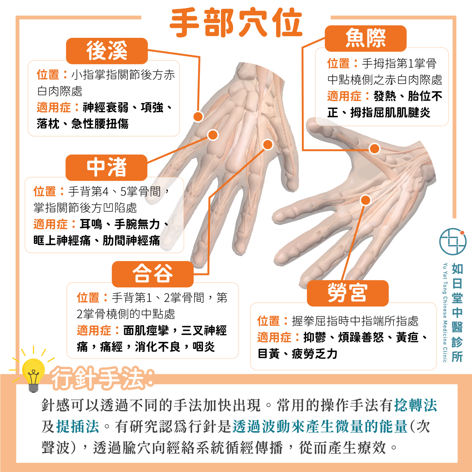 【手部穴位簡介】 - 如日堂中醫診所 Yu Yat Tong Chinese Medicine Clinic